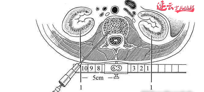 济南少儿编程:17岁女孩用人工智能,编写出了预测癌症的程序!~山东少儿编程~少儿编程(图9) 济南少儿编程:17岁女孩用人工智能,编写出了预测癌症的程序!~山东少儿编程~少儿编程(图9)